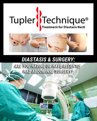 The Best Guide to Diastasis Recti Surgery? Find Out Now! - diastasisrehab