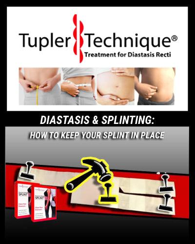 THE BEST SOLUTION TO KEEPING YOUR SPLINT IN PLACE - diastasisrehab