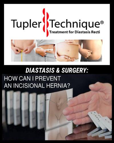 THE BEST WAY TO PREVENT AN INCISIONAL HERNIA - diastasisrehab