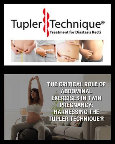 The Critical Role of Abdominal Exercises in Twin Pregnancy: Harnessing the Tupler Technique® - diastasisrehab