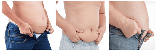 The Hidden Dangers of Diastasis Recti: Beyond Aesthetics - diastasisrehab