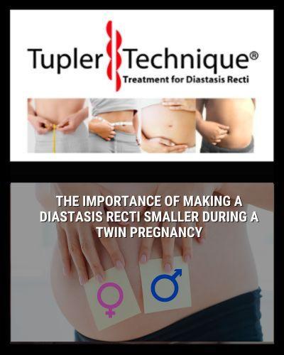 The Importance of Making a Diastasis Recti Smaller During a Twin Pregnancy - diastasisrehab