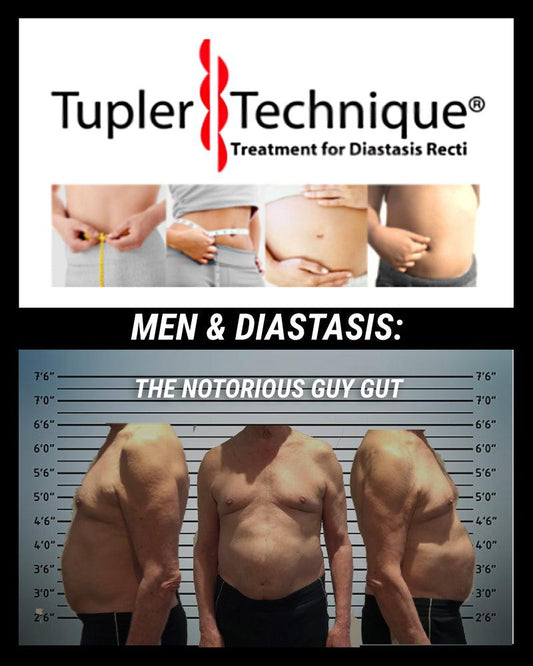 The Risk of Abdominal Separation in Men: Beyond the Guy Gut - diastasisrehab