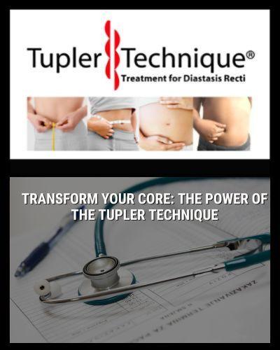 Transform Your Core: The Power of the Tupler Technique – diastasisrehab