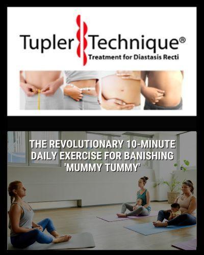 Transforming Postpartum Recovery: The Power of the Tupler Technique® - diastasisrehab