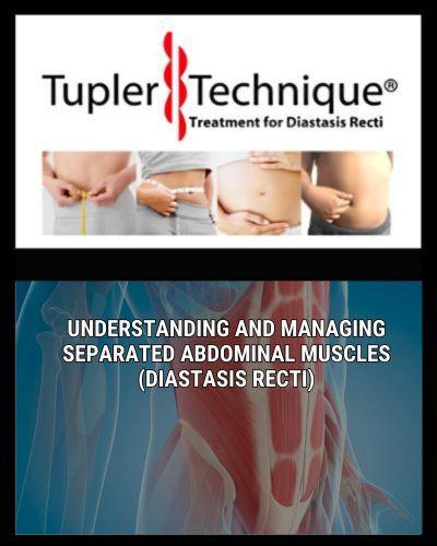 Understanding and Managing Separated Abdominal Muscles (Diastasis Recti) - diastasisrehab