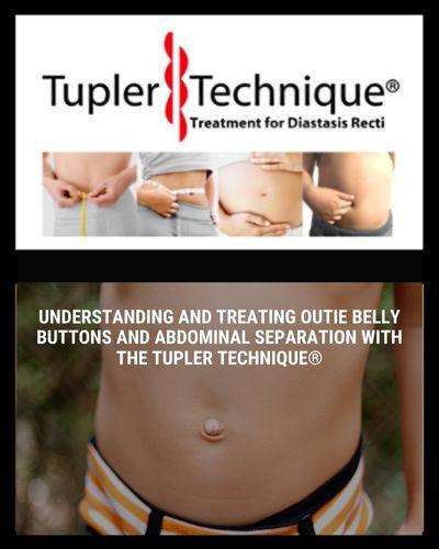 Understanding and Treating Outie Belly Buttons and Abdominal Separation with the Tupler Technique®