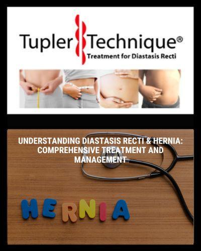 Understanding Diastasis Recti & Hernia: Comprehensive Treatment and Management - diastasisrehab