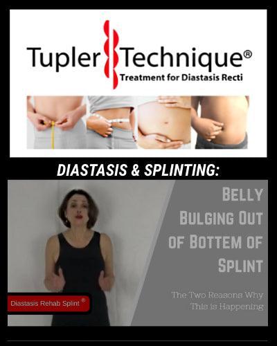 What if My Belly is Bulging Out of the Splint - diastasisrehab