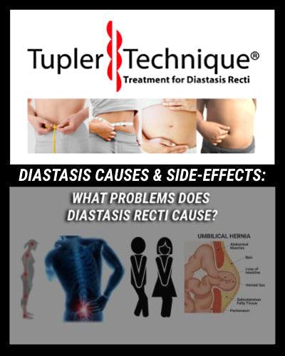 WHAT PROBLEMS DOES DIASTASIS RECTI CAUSE?