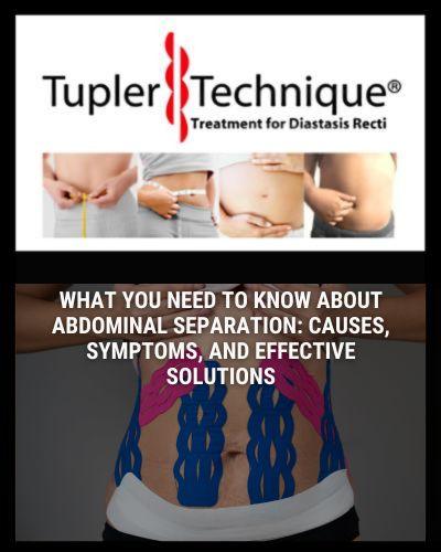 What You Need to Know About Abdominal Separation: Understanding and Treating Diastasis Recti - diastasisrehab