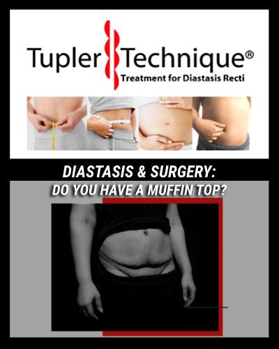 You need to know this if you have a muffin top belly | TUPLER TECHNIQUE® - diastasisrehab