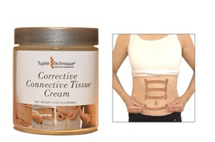 Diastasis Rehab Cream & Tape Package - diastasisrehab